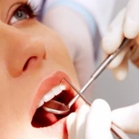 Teeth Implants 6