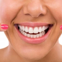 Professional Teeth Whitening 0