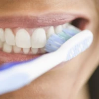 Professional Teeth Whitening 2