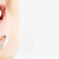 Dental Implant Procedure 15